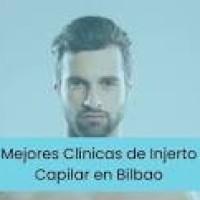 clinica-capilar-bilbao-opiniones